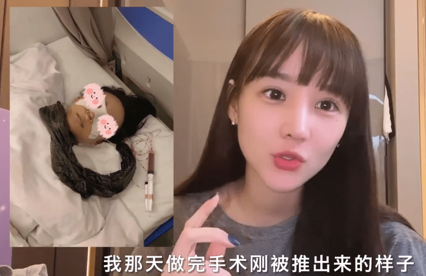 uzi女友爆整容经历!素颜出镜后网友直呼:太美了!