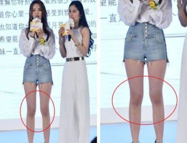 原创为什么漂亮女生的膝盖上经常会出现淤青看完就全明白了
