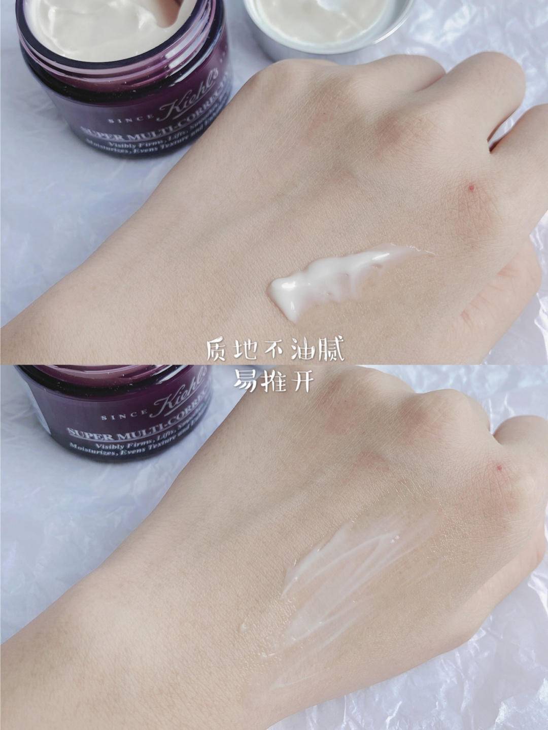 巅峰|法令纹还有救吗？想要重返颜值巅峰，还真的靠这点