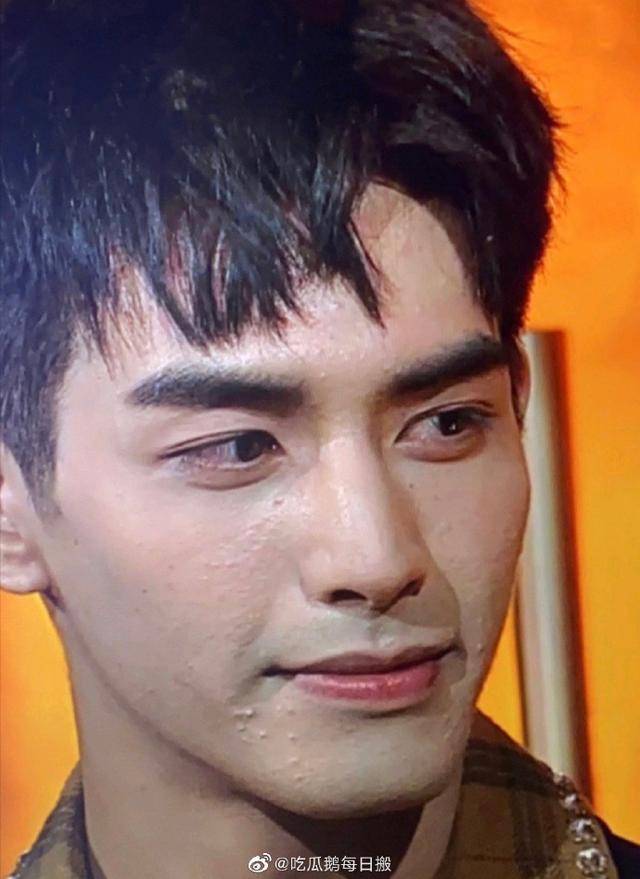 金鹰节|金鹰节开幕魔鬼打灯又来了！宋威龙满脸痘印，张萌脸部肿胀