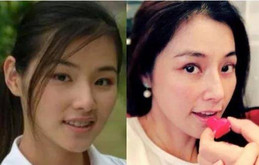 朴敏英|9年换5次头，do得毫无痕迹，双眼皮竟然还都是亲爸割的...