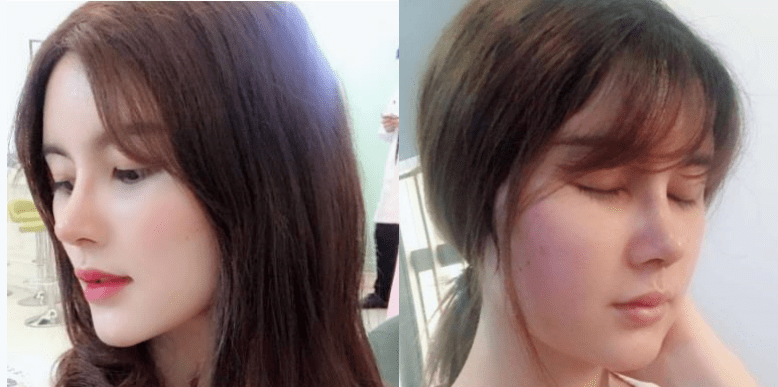 赵丽颖|鞠婧祎和赵丽颖竟然是同一个医生？