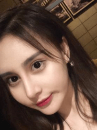 赵丽颖|鞠婧祎和赵丽颖竟然是同一个医生？