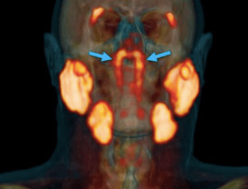 头骨|荷兰科学家在头骨底部发现新的器官
