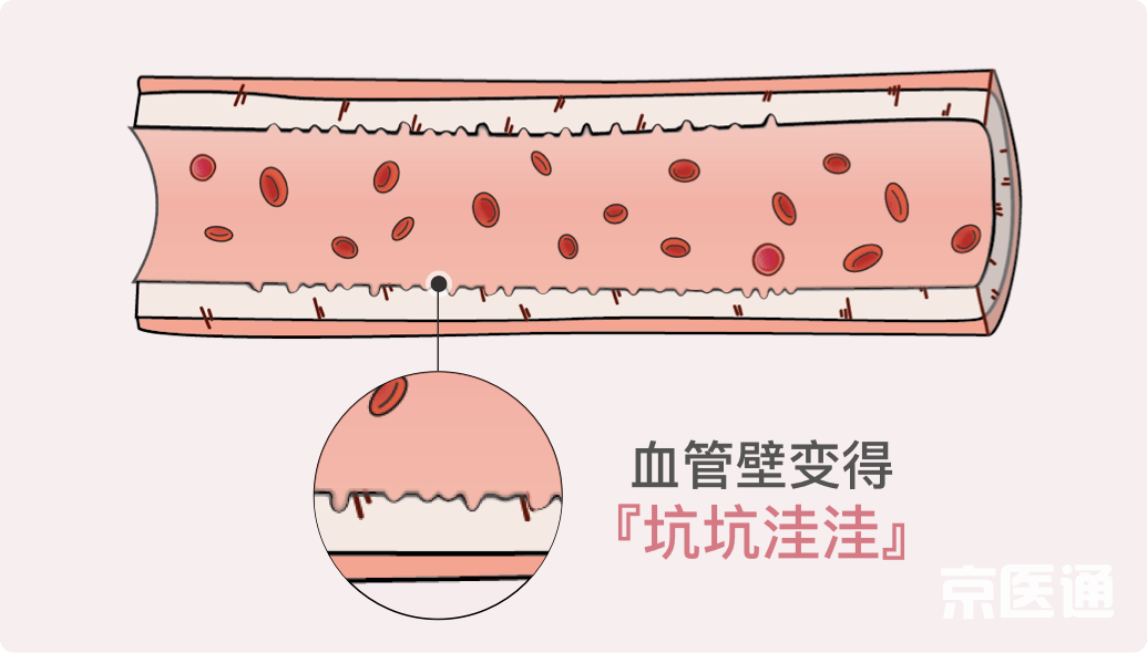 什么血为什么成语_成语故事图片(3)