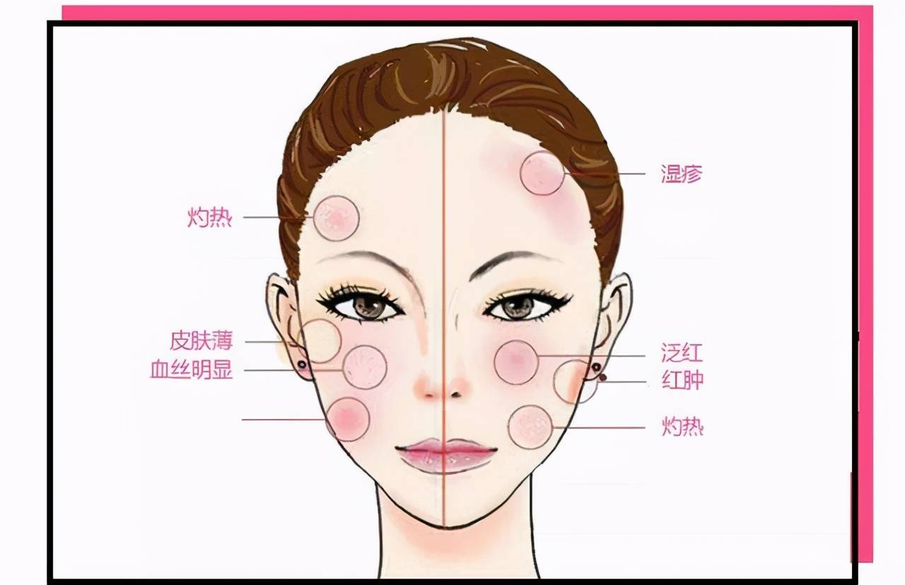 敏感肌如何护肤？应该如何护肤？