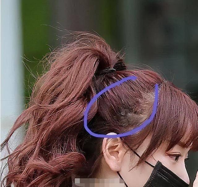 蒋梦婕|女明星为了发际线有多拼？蒋梦婕戴假发片，鞠婧祎糊了满脑袋粉