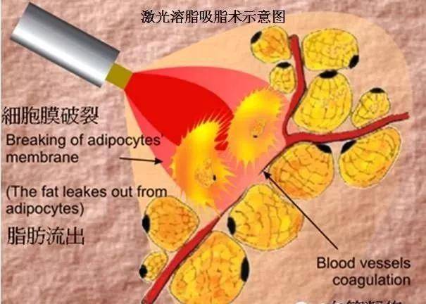 脂肪型|赵露思费劲巴拉才撕下大饼，秒被书粉喊退货，发布会生图确实让人出戏...