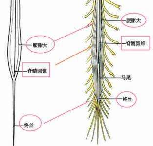 脊髓圆锥综合征和马尾神经综合征两者之间有什么关系详细解读
