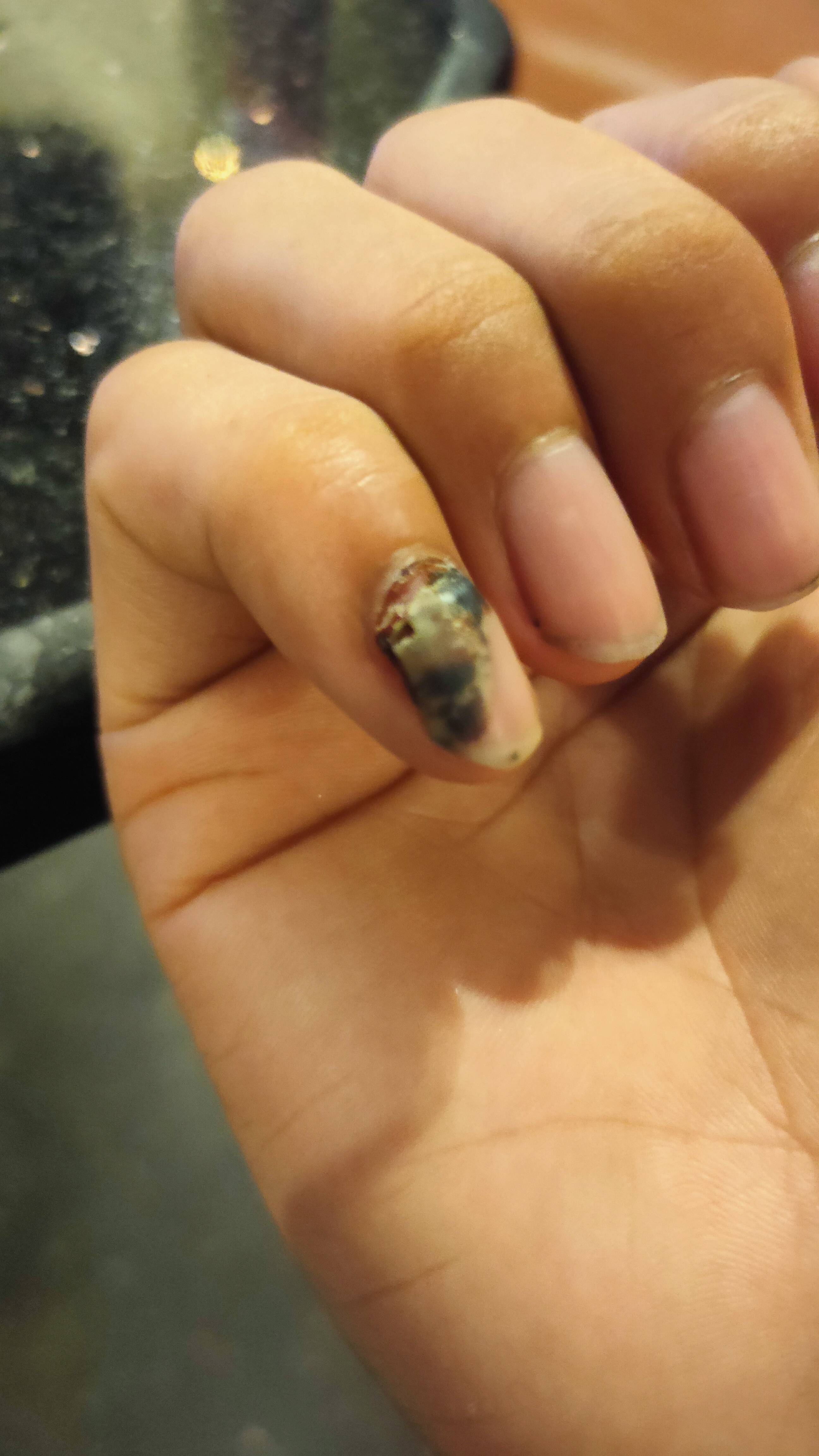 手指被压是一种什么样的体验