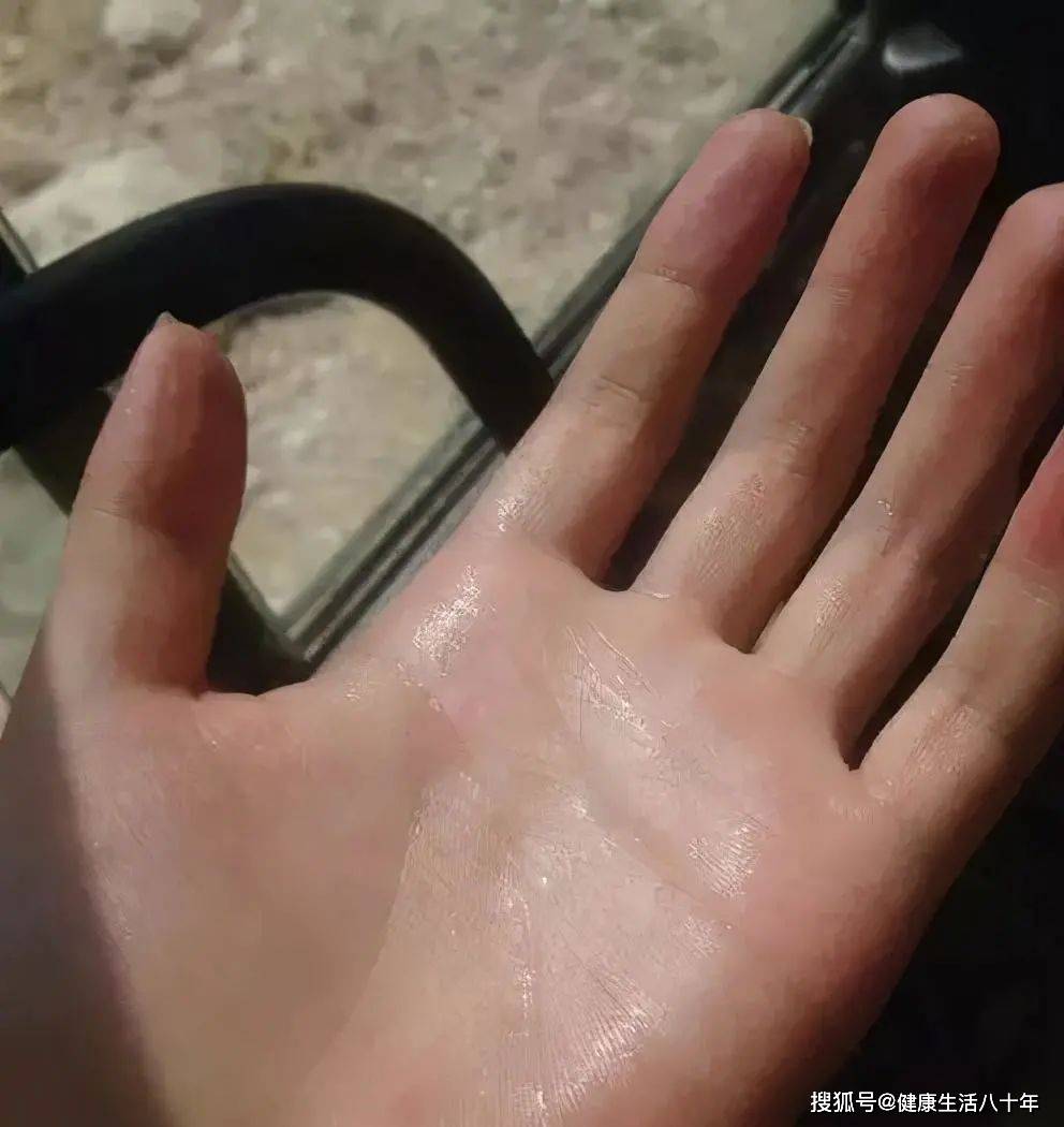 不是很大；如果体质较弱，手心又常出汗，其患有肾虚的可能则相对较高。