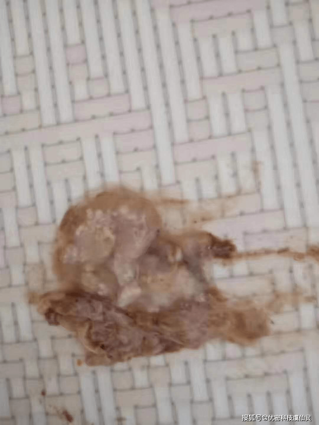 1,宫寒分泌物 4,宫颈纳囊 11, 流产后残留 责任编辑