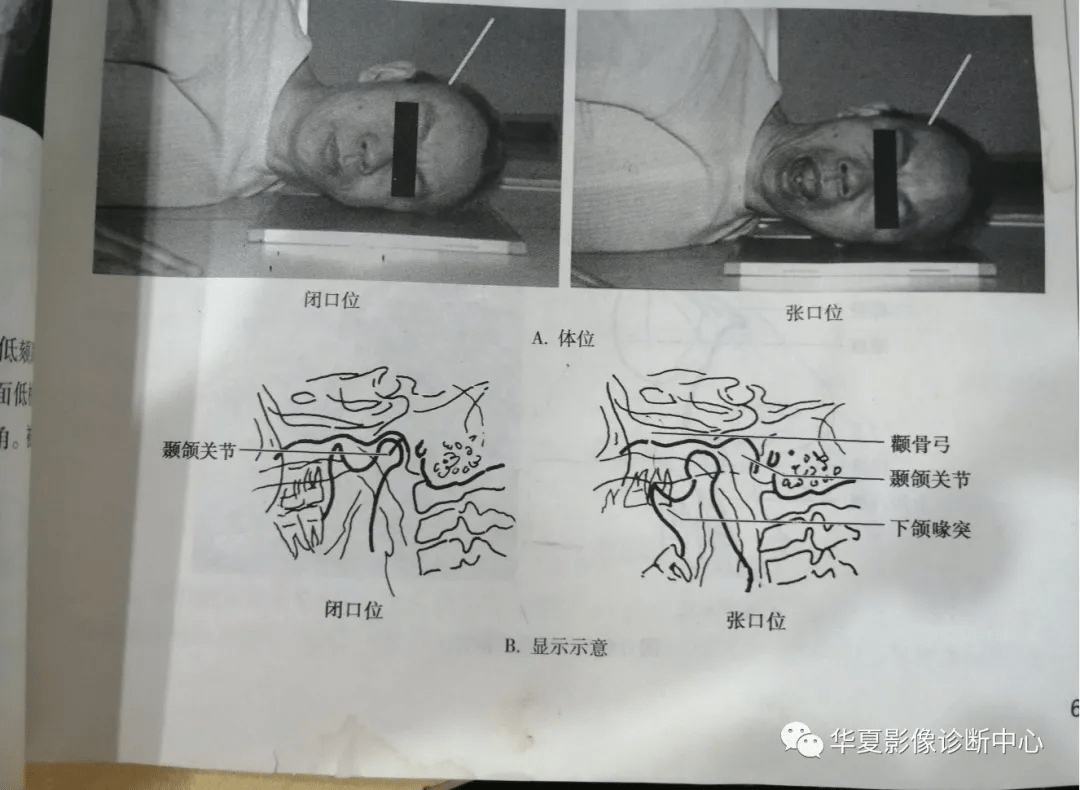 医用放射设备dr摄影目录