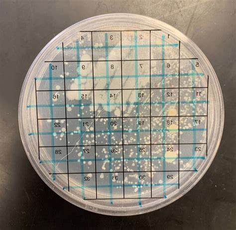 菌落总数超标的原因以及应对方案