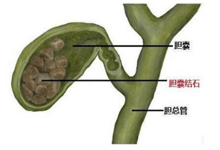 6b91c7871cac4e9d89ec163ce72b219a.png