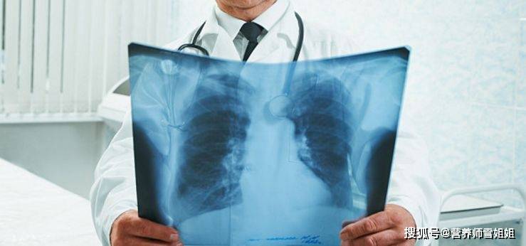 53岁男子不痛不痒查出肺癌手指有3种异常去查查肺