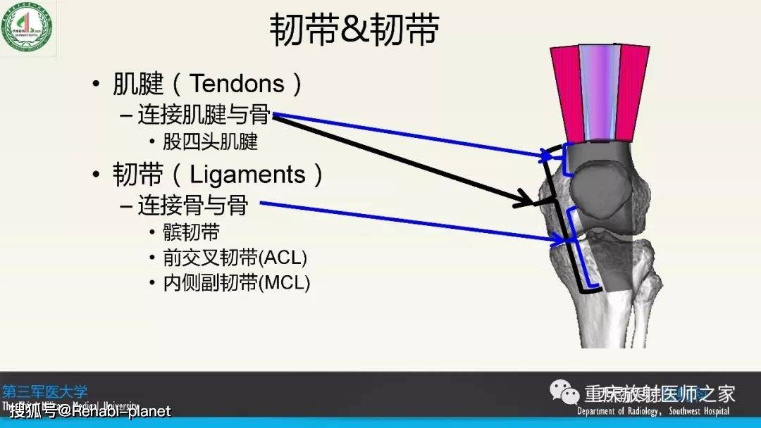 膝关节mri膝关节韧带解剖及mri诊断精确到每个细节