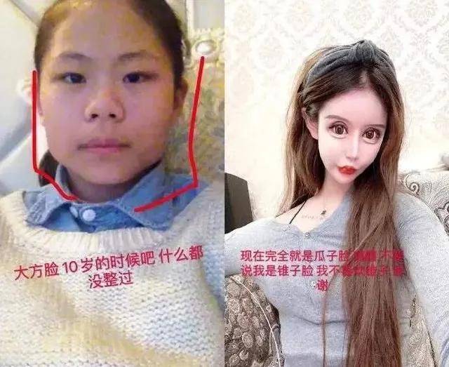娃娃|那些13岁开始整容的人，花了400万整成凡尔赛娃娃的模样