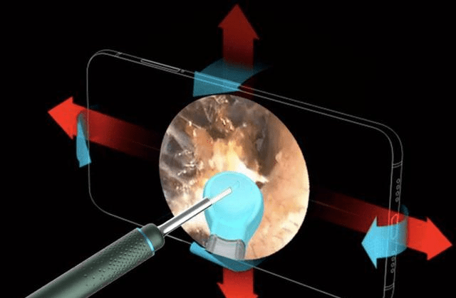 再现新科技!蜂鸟智能可视采耳棒,无伤采耳效果极佳