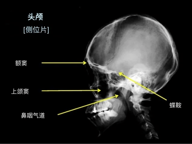 一文说清|头痛要做哪些检查?医生告诉你其中的秘密