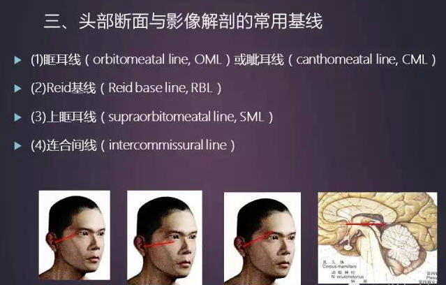 今日详细解读基础 头颅应用解剖_手机搜狐网