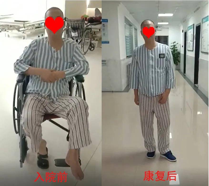 深圳中风偏瘫患者没想到在正康骨科站起来了