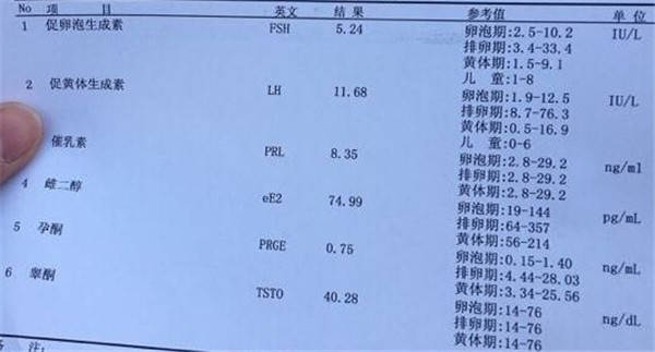 什么是性激素六项?检查的时间段和注意事项分别有哪些