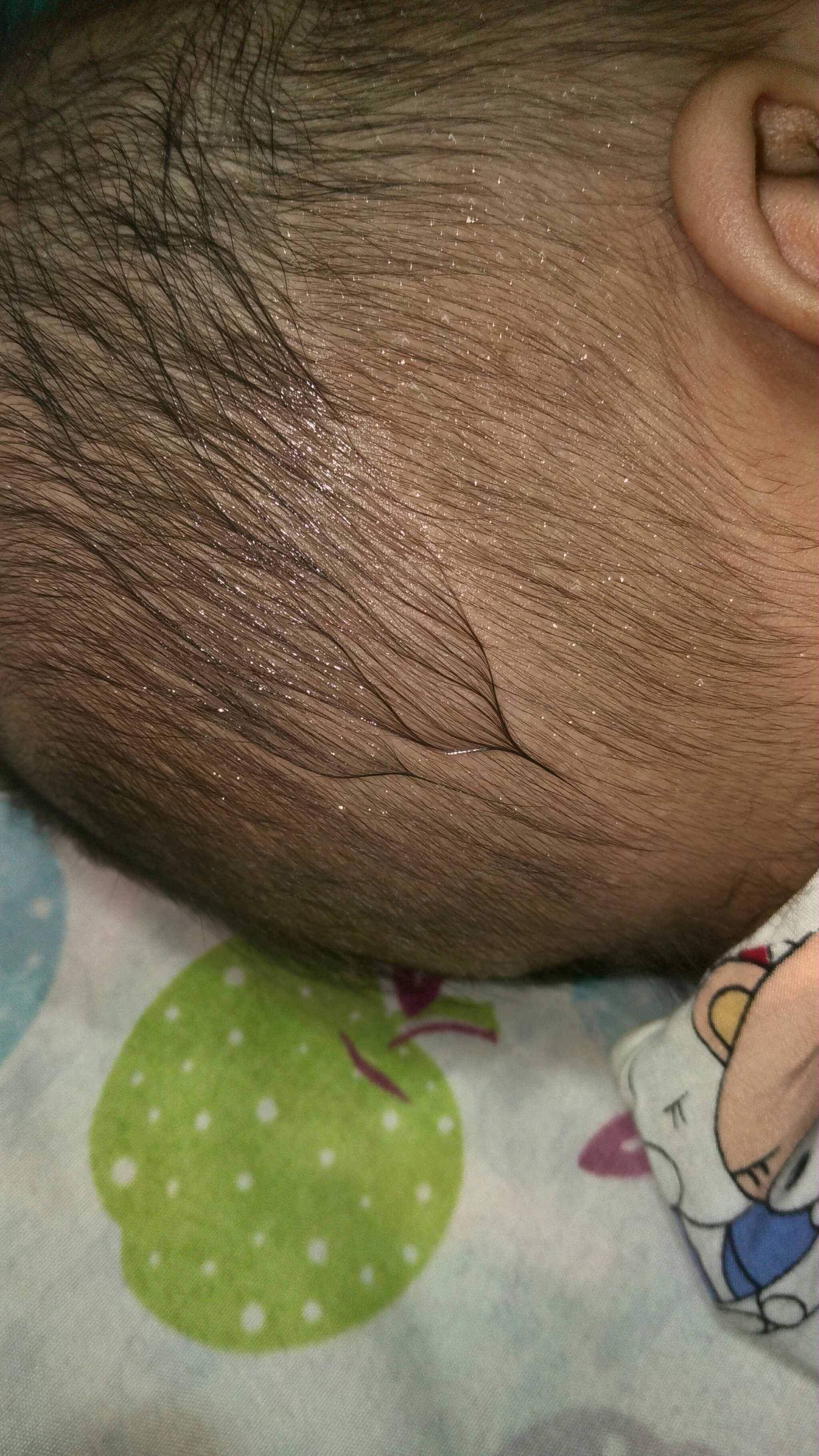 小孩子运动后出汗多怎么回事 b3dd800c00894271bcfdbe12001a1afb.jpeg