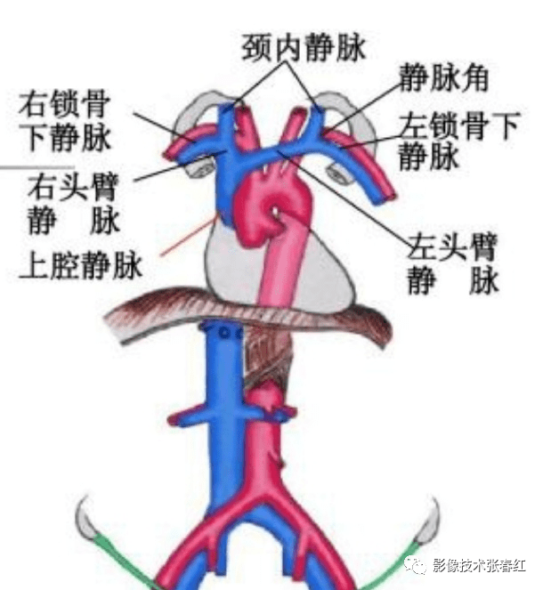 头颈cta扫描时留置针打在左侧时如何扫描_静脉