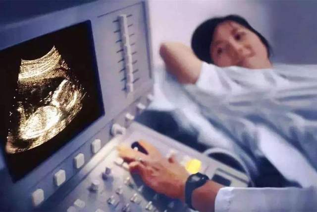 什么时候检查nt最好 445580a7382c40088d426f6fc5c01e3b.jpeg