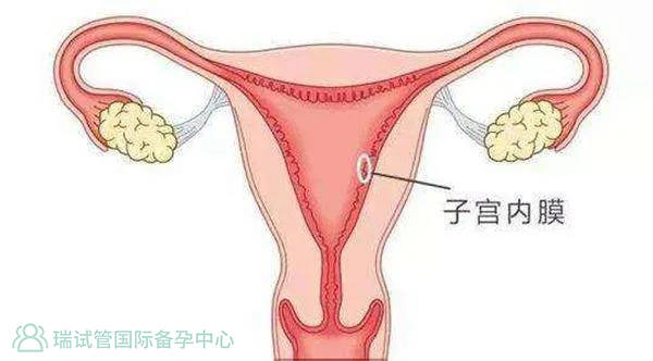 535ce8a0f9cf4e89a2a589e00c9ef7b9.jpeg