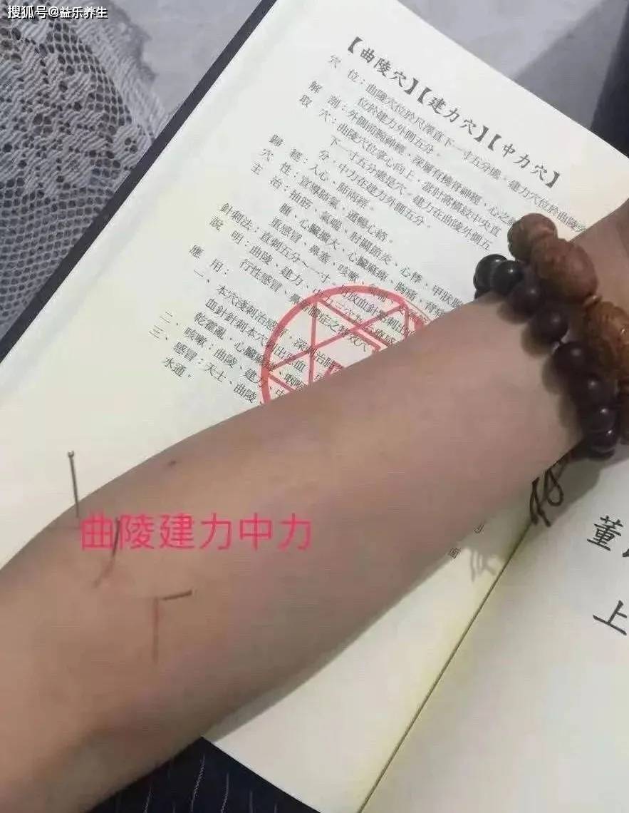 董氏奇穴针灸曲陵穴建力中力