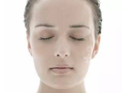 什么样的算痘印 342d93a5a70345e7bb9b789c2dc229aa.jpeg