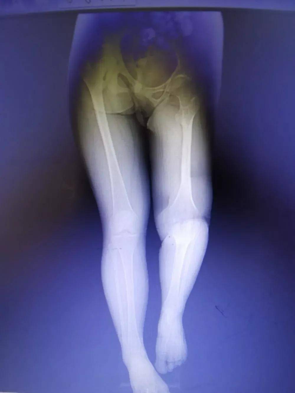 关节医院排名_手指关节图