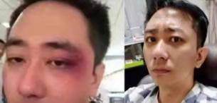 王自健回归抑郁症大好，前妻却风言风语暗讽，