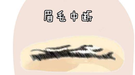 拍眉什么成语_成语故事简笔画(2)