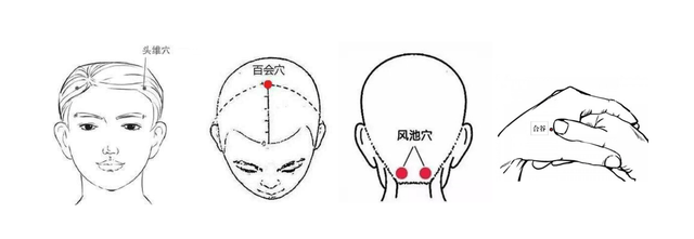 得了斑秃怎么办