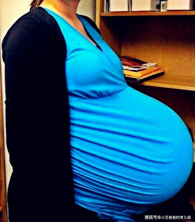 有医生表示,孕妇的肚子有长的也有圆的,其实是根据胎儿形成的状态有