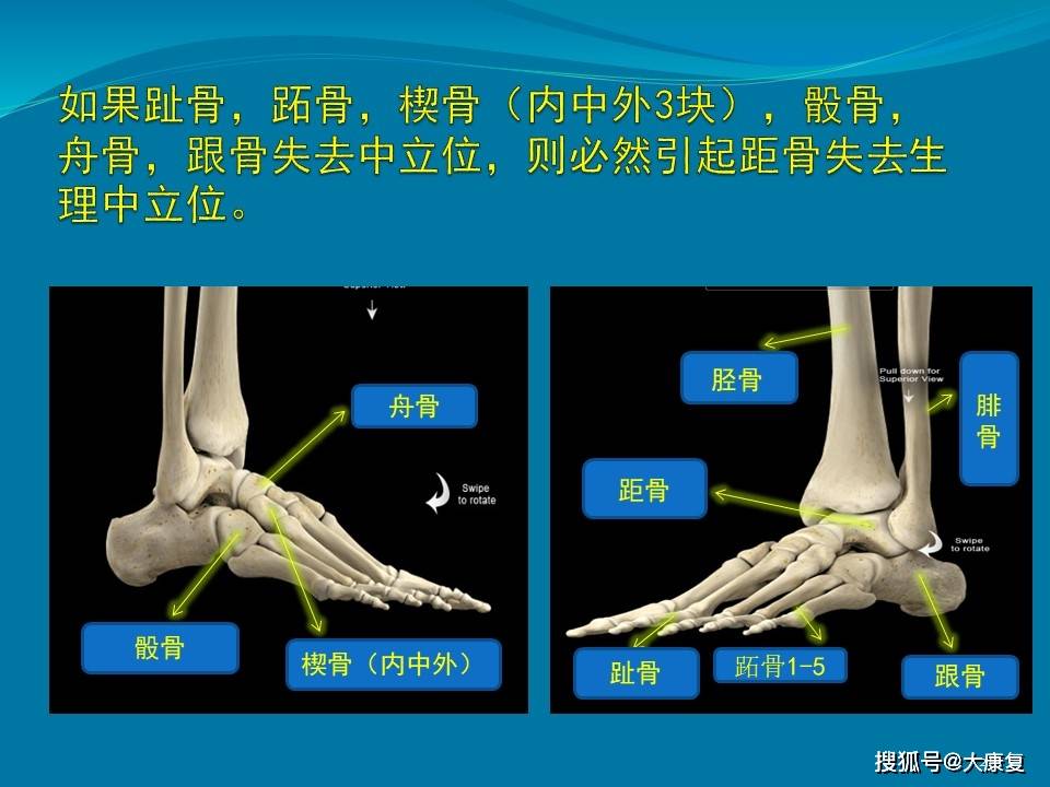 下肢生物力学足部矫形