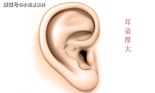什么样子的耳朵最聪明 01a0f51d2333425c87c831c1cbaff165.jpeg
