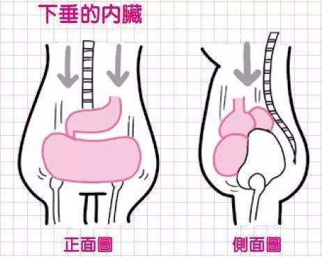 颜无痕小课堂产后内脏会下垂