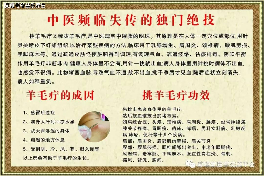 "羊毛疔"挑治术的特点以及反应点寻找方法