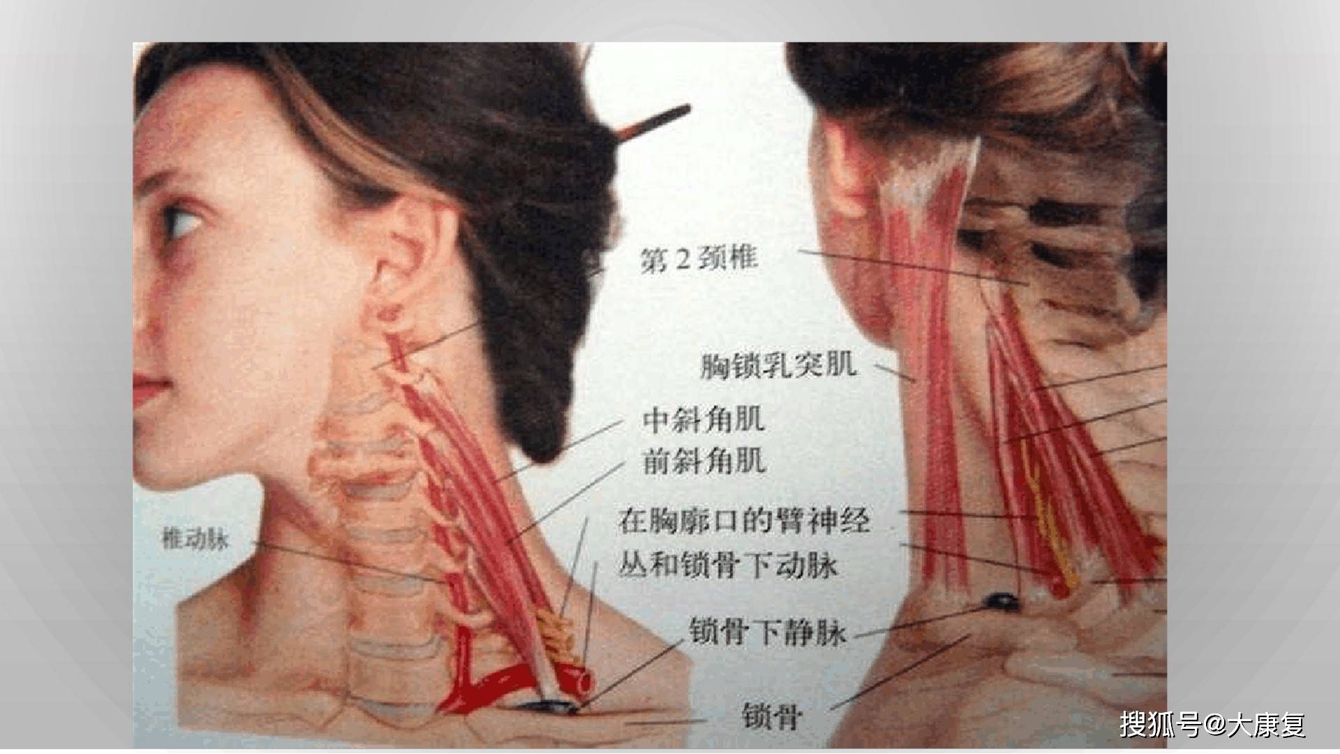 宣蛰人压痛点强刺激推拿法