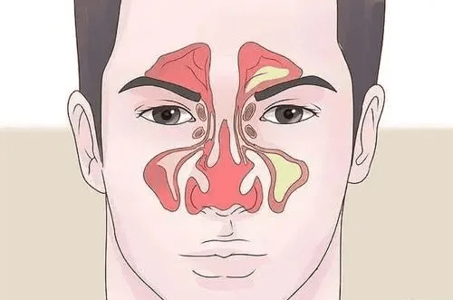 你有真正地了解过自己的鼻子吗?
