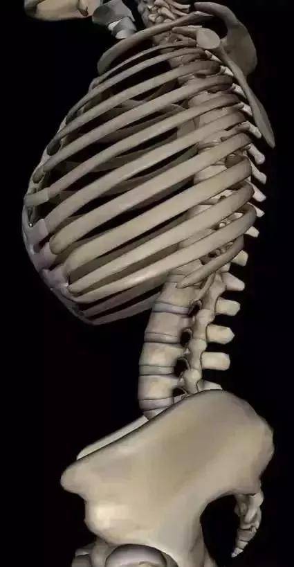 详解脊柱侧弯的成因评估及康复河南安阳足脊矫形