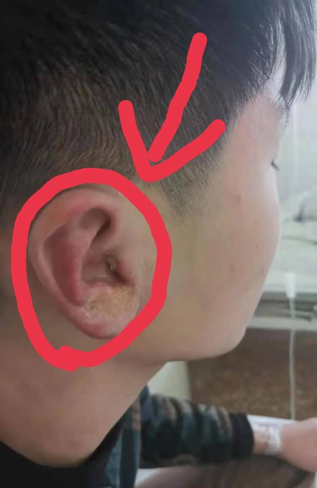 怎么样可以让自己耳膜穿孔 ca04df1f81f14456930135cdb165b3d5.jpeg