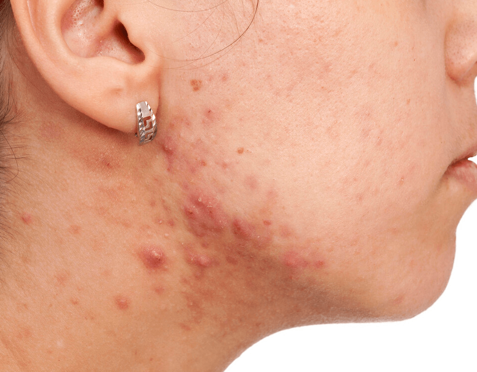 吃什么东西对肝脏有好处 9d1a54da0618445e82a0ebd12c1e922e.png