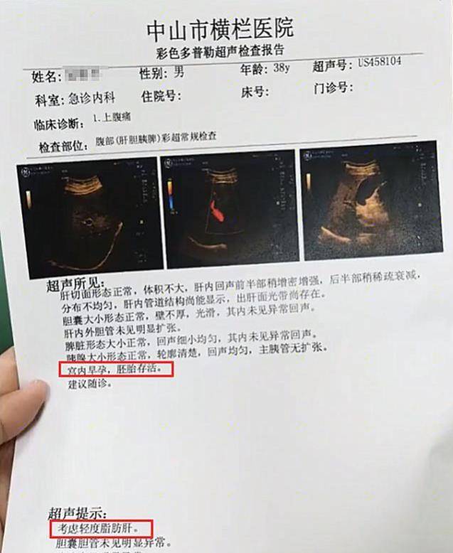 医院检查怀孕b超多少钱 5b0af54b7f2244f5be8aac924e10a96d.jpeg