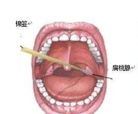 【咽拭子】健采医疗:核酸检测为什么使用咽拭子偏多?