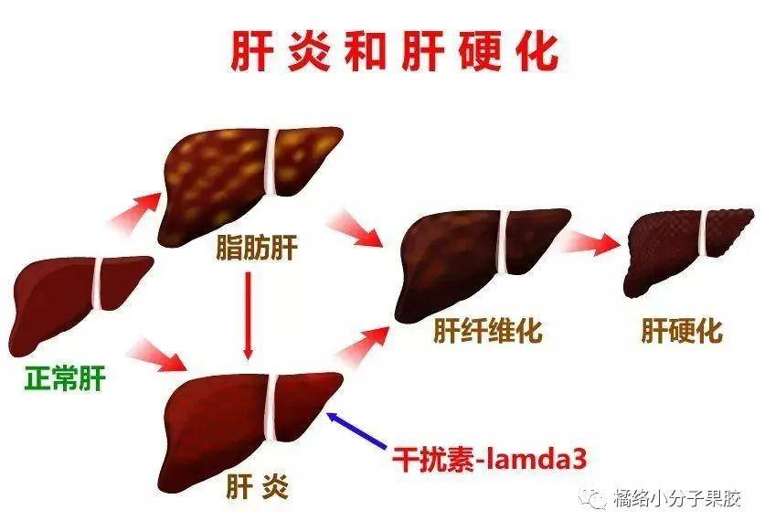 肝脏纤维化是肝脏疾病在形成过程当中,所表现出来的一种病理现象.